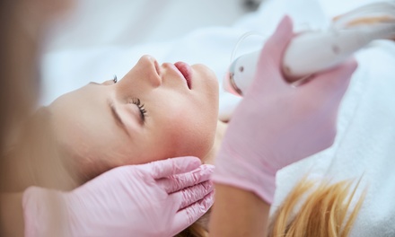 Limpieza facial con masaje y opción a dermapen y tratamiento específico en Clínicas Láser Fusión Sevilla